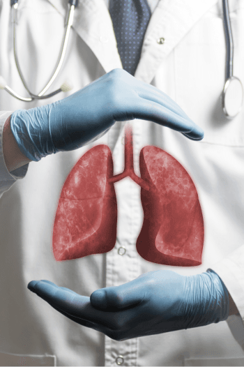 Klinik Paru Onkologi